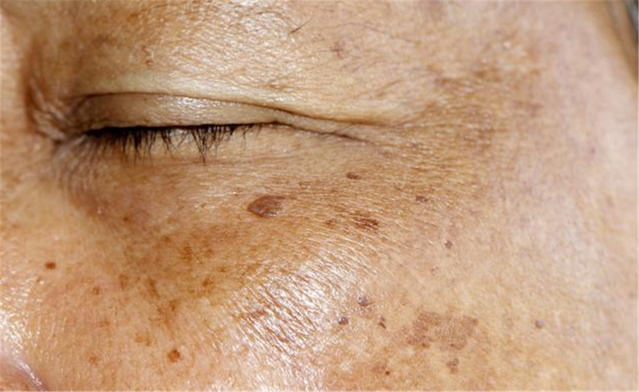 女人月经量少能引起什么病症,女人月经量太多了什么原因