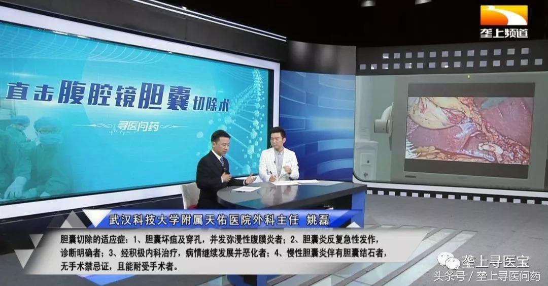 视觉盛宴!速来围观!现场直播腹腔镜胆囊切除术全过程!