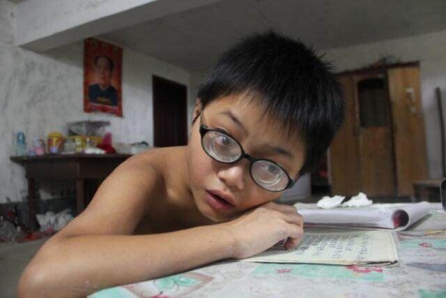 青少年近视弱视矫正,儿童近视1000多度加弱视能治好吗