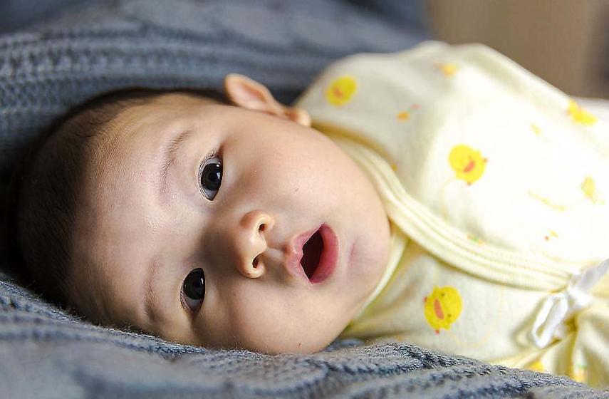 生命的奇迹，胎儿6个月时脑部静脉丛囊肿，出生后一切正常