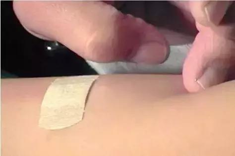 小小一根棒，比套套和上环安全，避孕率超高却少有人知道