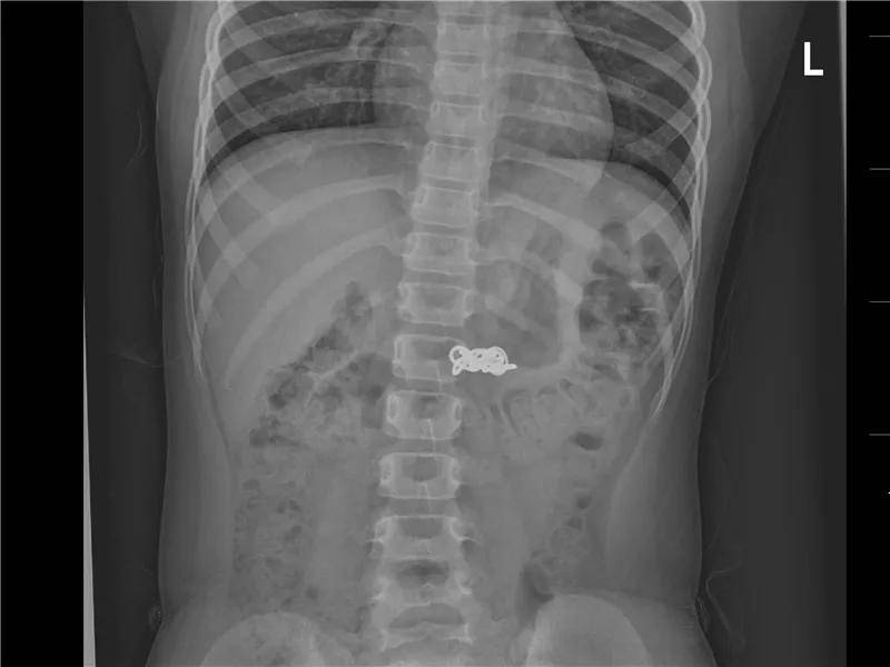 一些让人毛骨悚然拍到的照片,六个令人毛骨悚然的影像