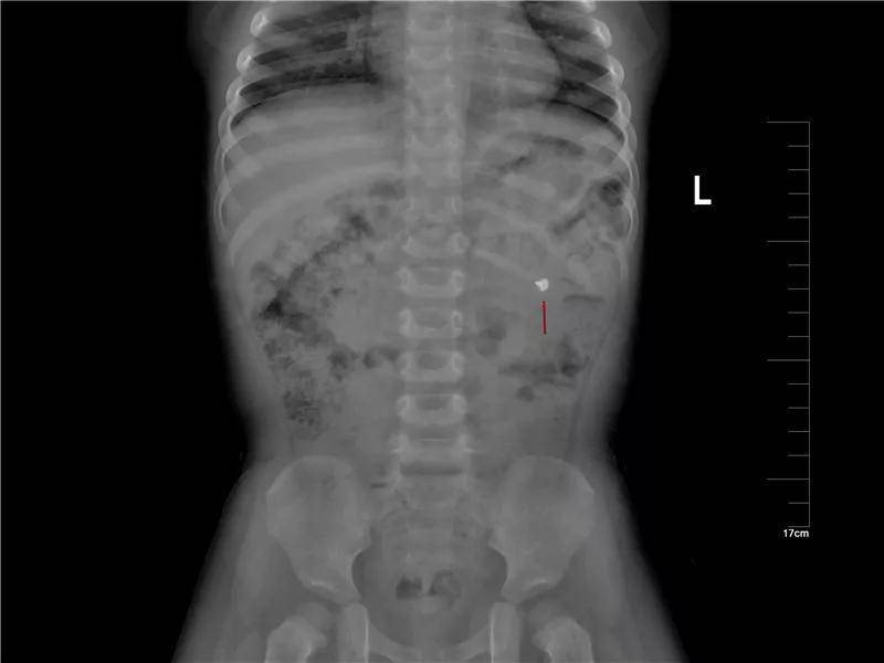 一些让人毛骨悚然拍到的照片,六个令人毛骨悚然的影像