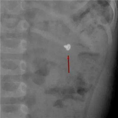 一些让人毛骨悚然拍到的照片,六个令人毛骨悚然的影像