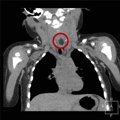 一些让人毛骨悚然拍到的照片,六个令人毛骨悚然的影像