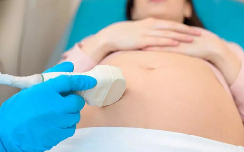 超声检查是怎么回事,做超声检查抹的是什么