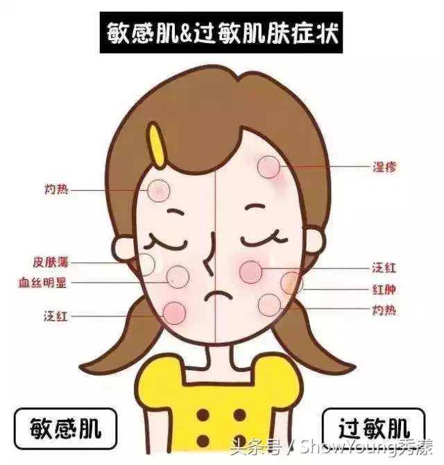 眼部过敏发红皱巴巴还脱皮,换季过敏脱皮怎么办