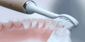 颜值超高超级好用的电动牙刷,少女心爆棚高颜值的电动牙刷来了