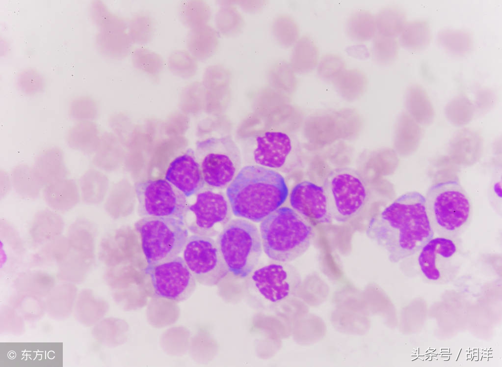 血小板减少会诱发哪些疾病,引起血小板低有哪些因素