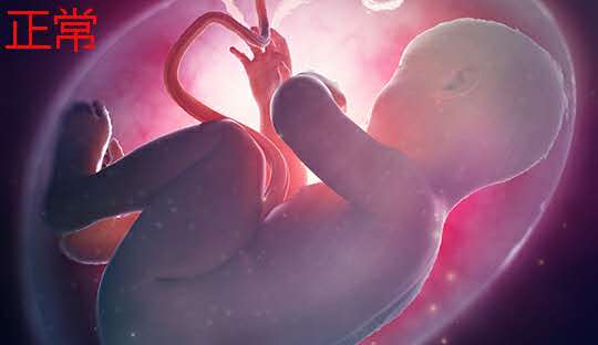 孕早期nt检查胎儿不动怎么才能动,孕早期先做nt还是先建档检查