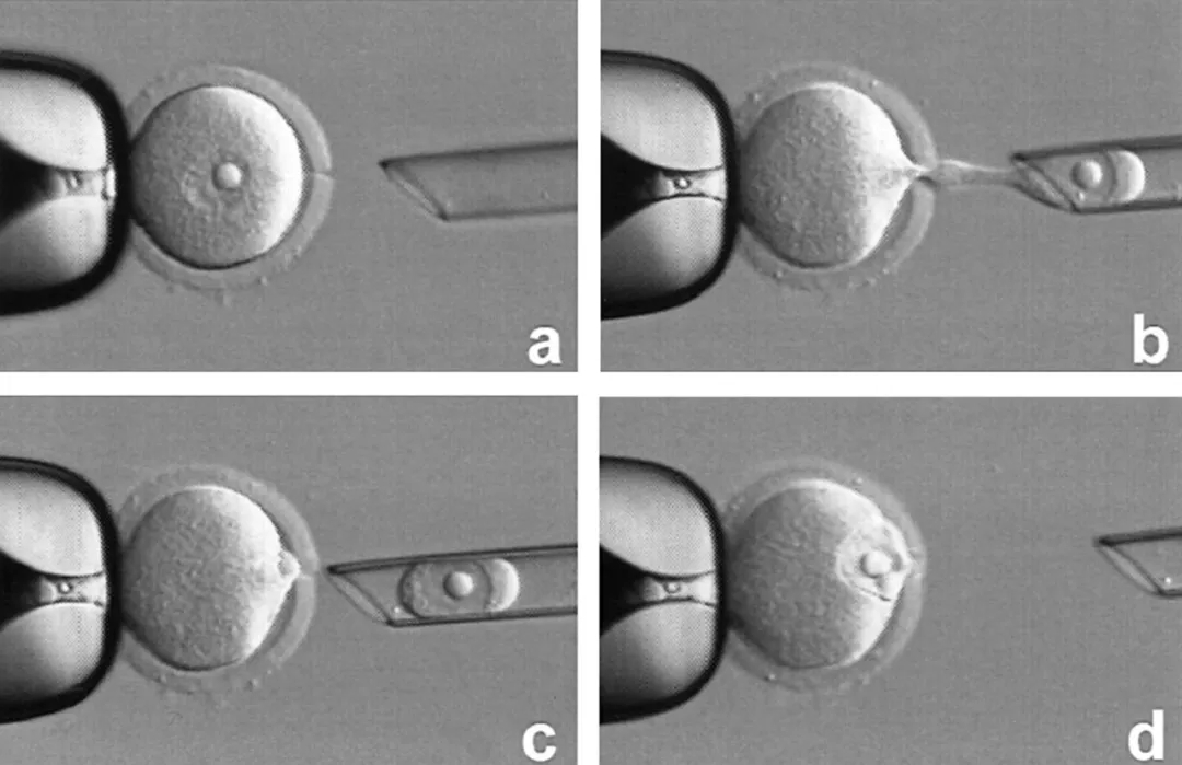 试管婴儿20问你想知道的都在这里