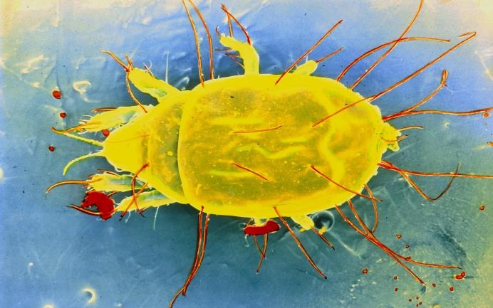 怎么除头螨虫最有效方法,头上螨虫怎么去除简单方法