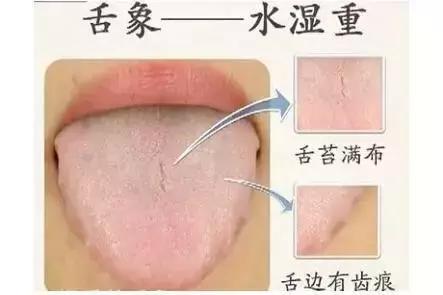 补气血需要先通经络吗,补气血先要通淤堵吗