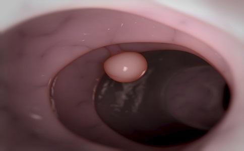 这四个部位长疙瘩当心是癌变,这4个部位有囊肿要警惕