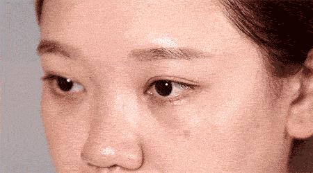 控制孩子近视,北京儿童医院眼科