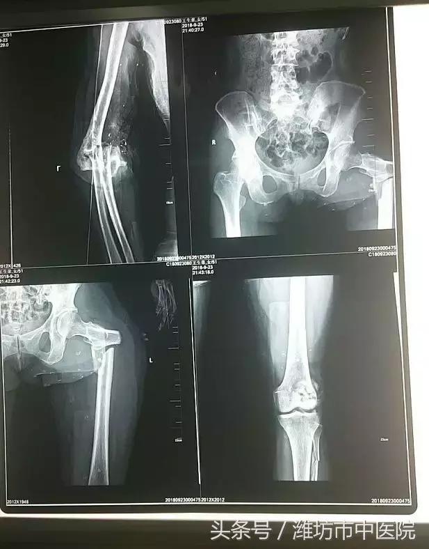 涓嶄竴鏍风殑鍥㈣仛,涓嶄竴鏍风殑鍥㈠渾