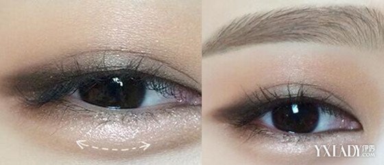 眼睛天生小怎么变大手术,眼睛天生小怎么办