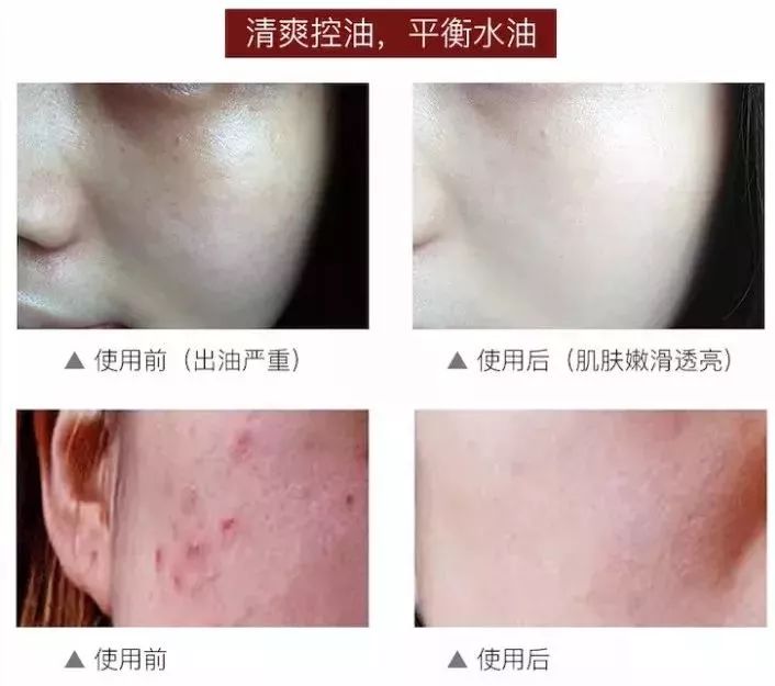 脸上污垢,脸上的脏东西真能清理出来吗