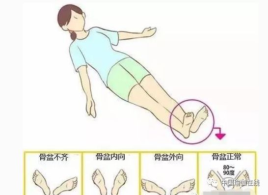 骨盆前倾练普拉提还是瑜伽,瑜伽调整骨盆前倾的体式有哪些