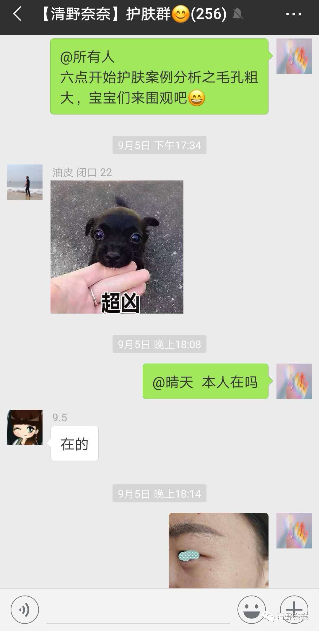 海绵微针后怎么护理,海绵微针第二天怎么护理