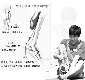 小腿前侧肌肉损伤多久可以好,运动时小腿肌肉损伤怎么治疗