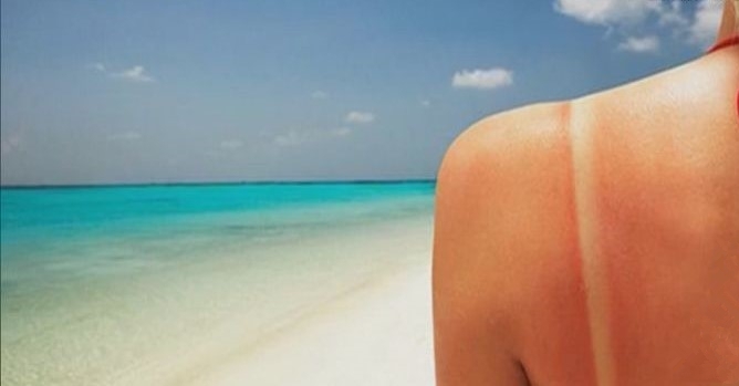 皮肤晒黑的最快土方修复方法,军训晒黑后如何修复美白脸部