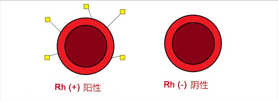 abo熊猫血中最稀有的血型,除熊猫血外什么常见血型最稀有