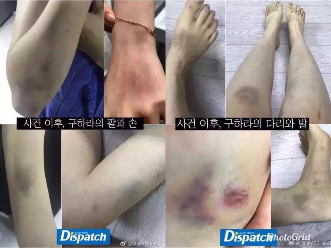 女星*爱性**录像带流出：女孩们都应该了解的色情复仇