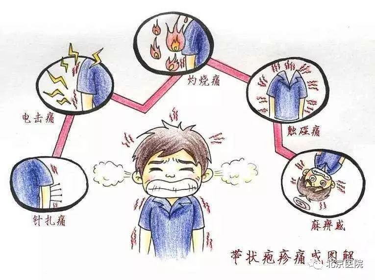 京医科普｜不长在腰上也是缠腰龙吗？