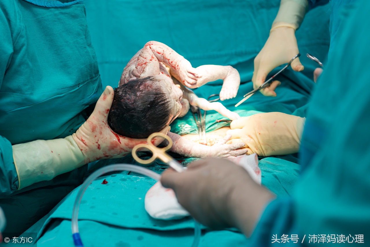 剖宫产第二次怀孕也要剖宫产吗,剖腹产后宝妈最怕什么