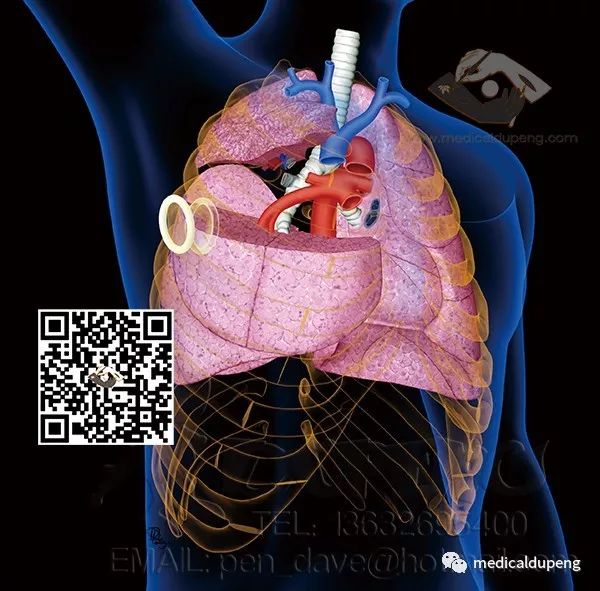 医学插画插图,医学插画sci