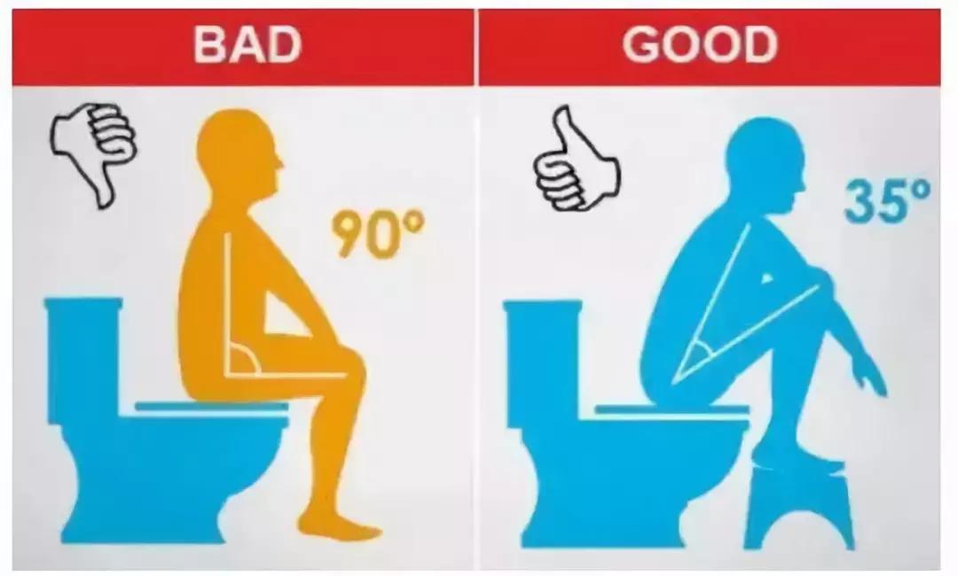 顺产一定会备皮吗,顺产容易宫内感染吗