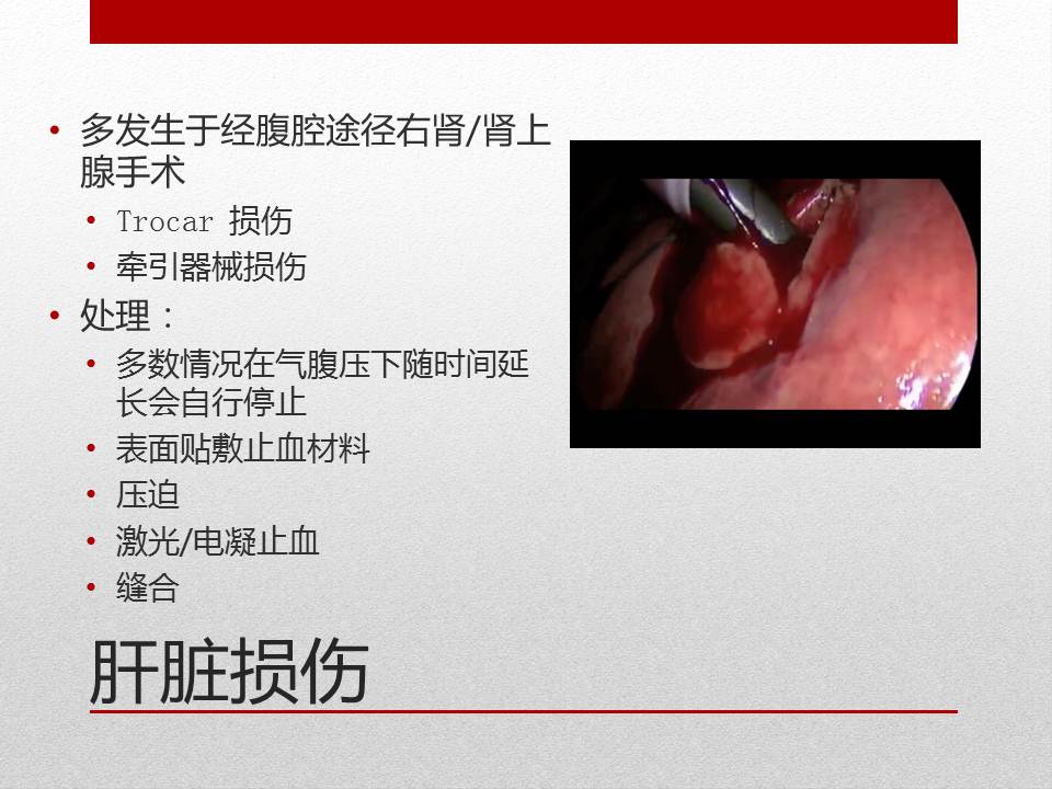 泌尿外科腹腔镜手术适应症,泌尿外科腹腔镜并发症
