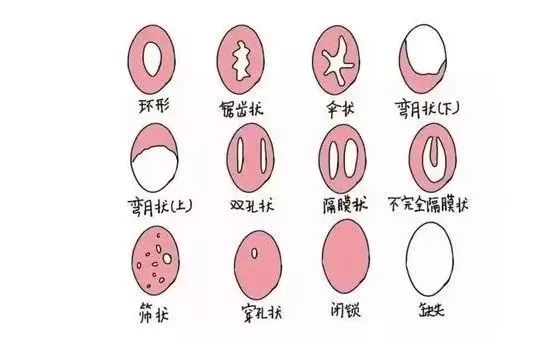 梁晓燕课堂:没来大姨妈,我可能是个假女人?