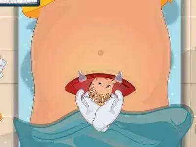 顺产和剖腹产的优势,剖腹产和顺产各有什么利弊