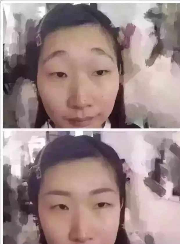 眉毛多有没有必要做眉毛,眉毛做不好看了还能改吗