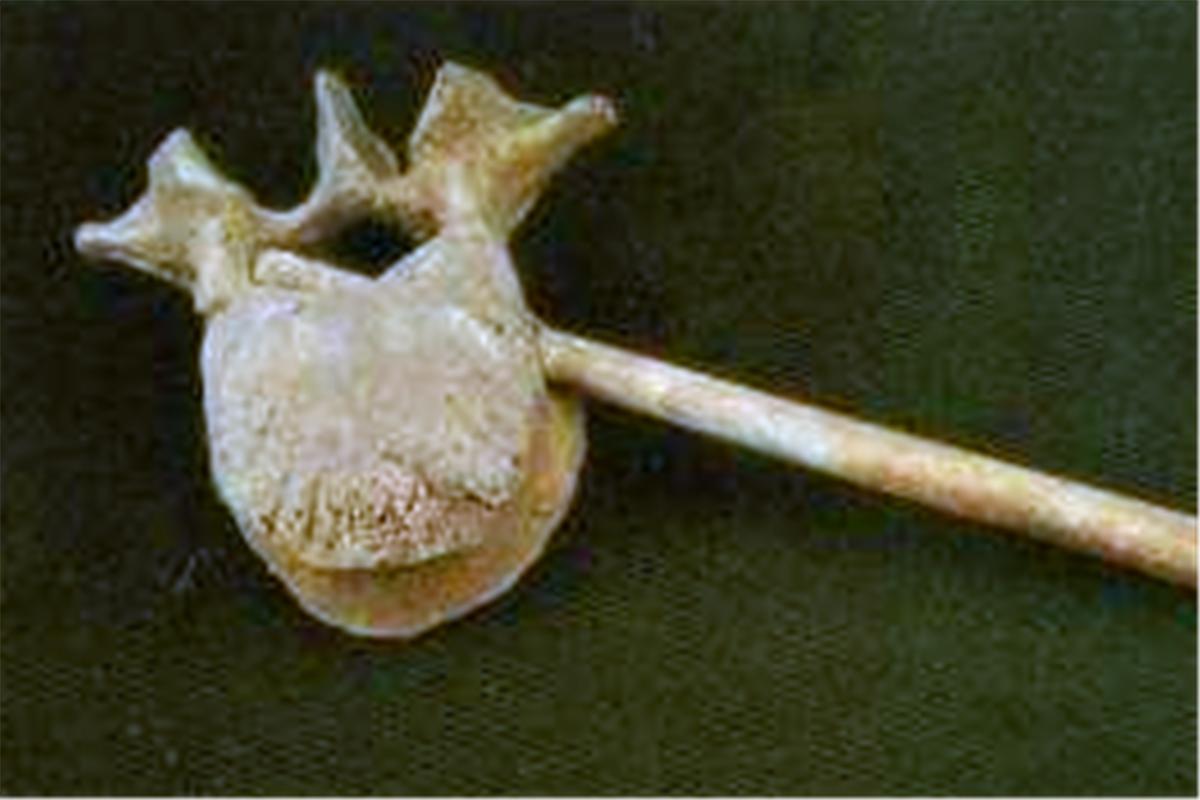 零口姑娘遇害事件,零口姑娘如何死的