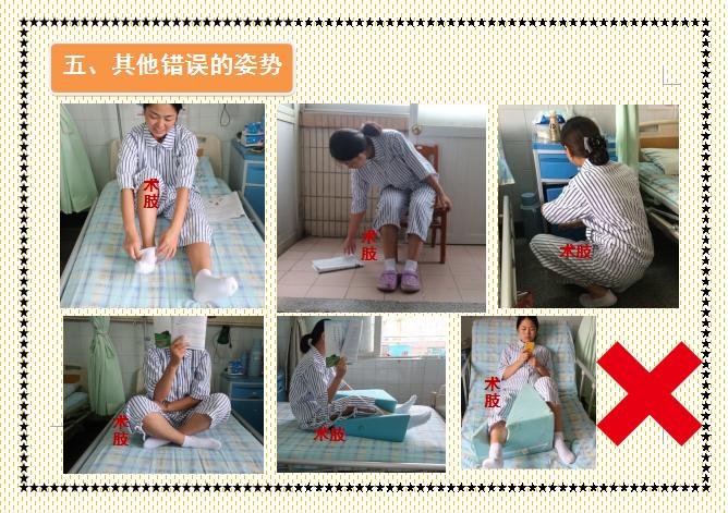 人工股骨头置换术术后教学查房,人工髋关节置换术后护理注意事项