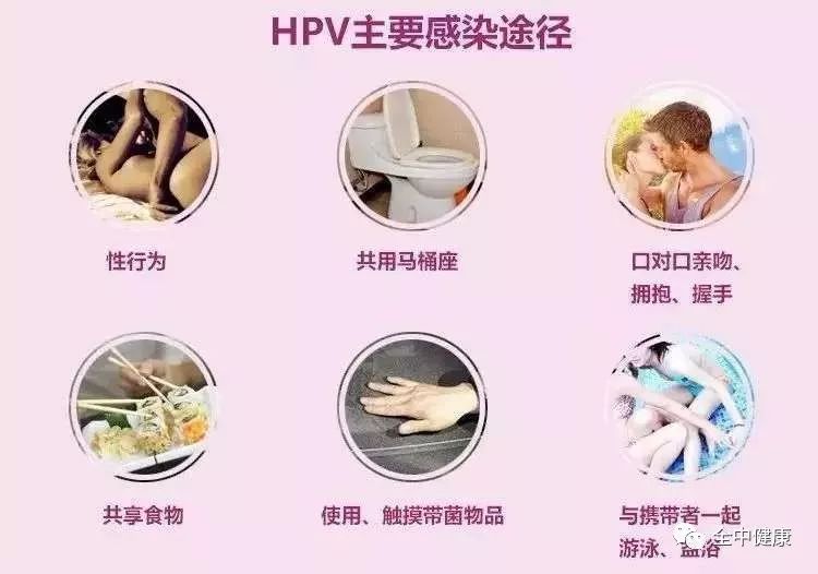 hpv感染发展到宫颈癌需要多长时间,hpv感染发展到宫颈癌要多长时间