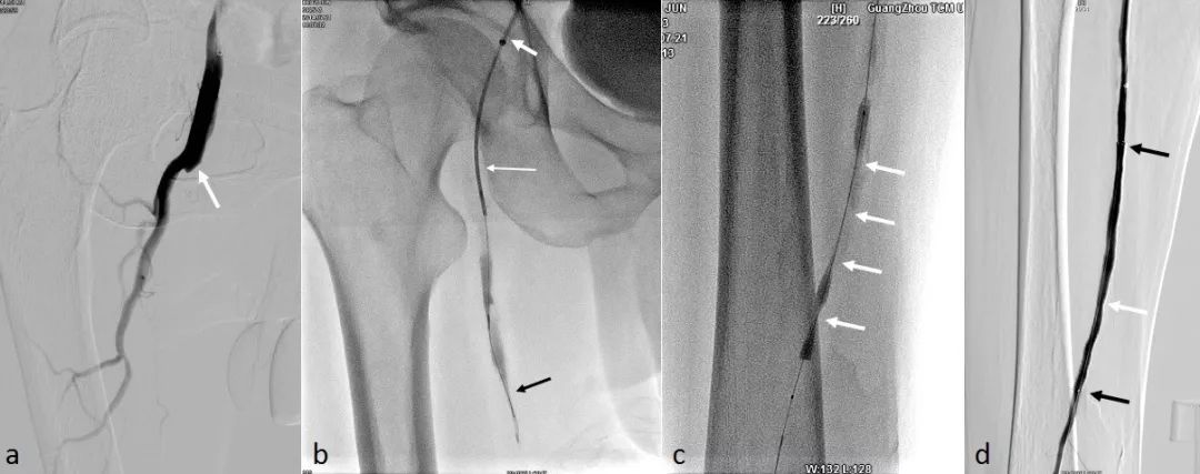 脚发麻发凉发痛应该挂哪个科,脚痛膝盖疼旁边筋痛