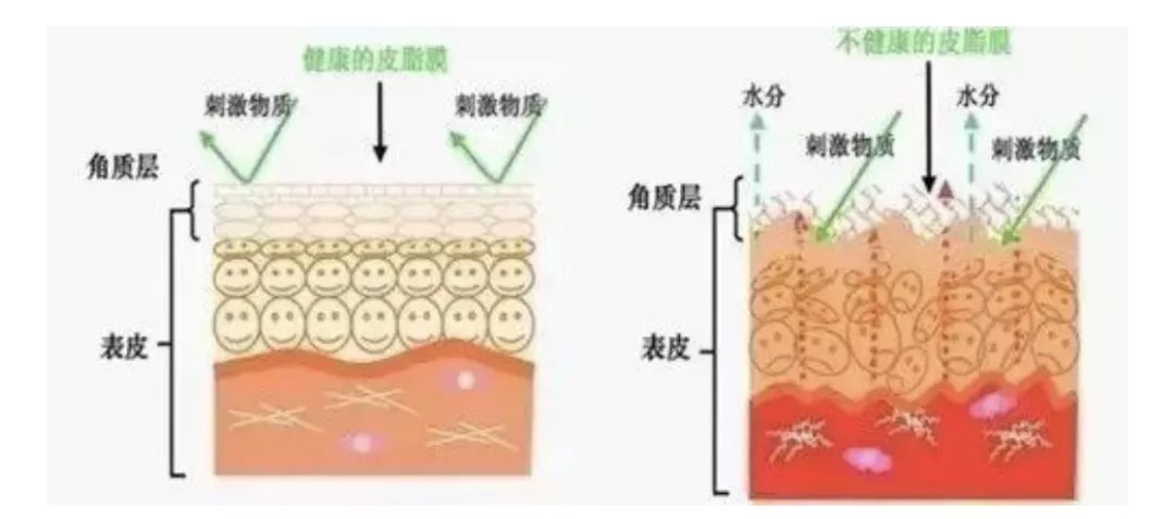 有了全世界3秒卖一瓶的“液体黄金“，干燥、长痘就与你无缘了！