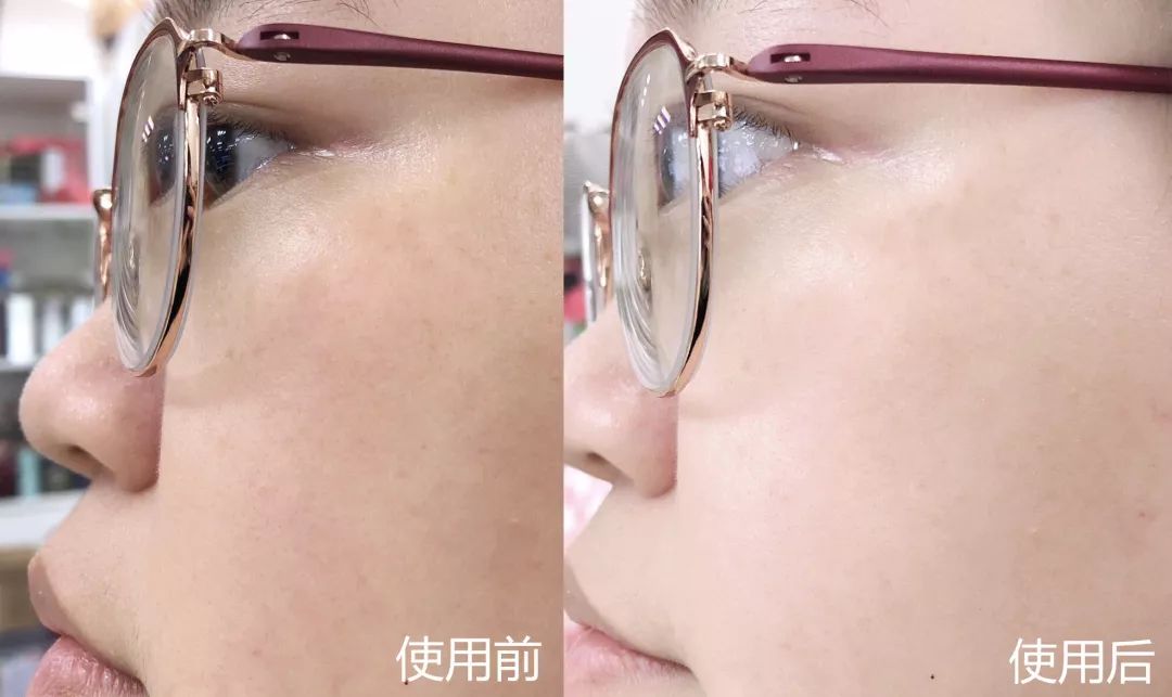 有了全世界3秒卖一瓶的“液体黄金“，干燥、长痘就与你无缘了！