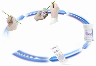 Hpv和tct检查结果怎么看,hpv和tct报告单怎么看