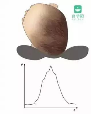 宝宝偏头斜头严重长大了会好吗,宝宝头偏脸歪有什么办法吗