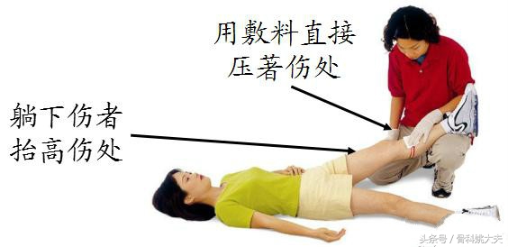 意外受伤时止血的正确做法是,被割伤怎么止血