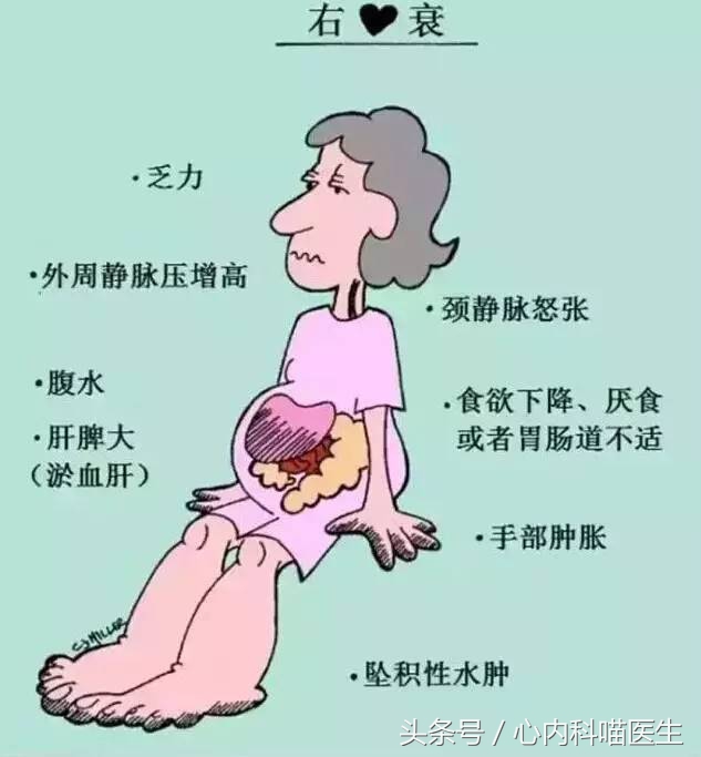 心衰的6个早期信号,心脏病患者心衰有什么症状