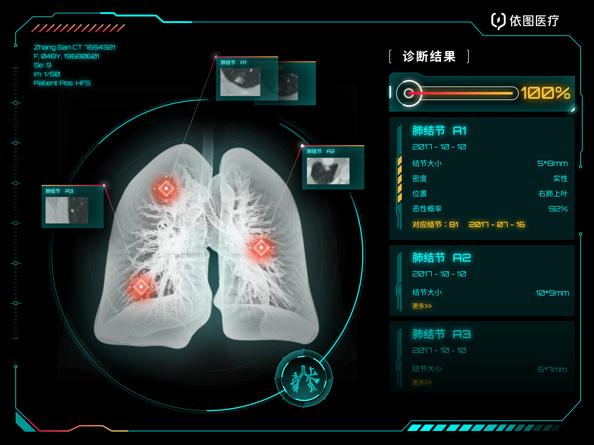 沉浮的资本，进击的CV