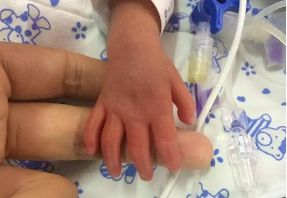 出生2斤多宝宝,出生2斤重的宝宝