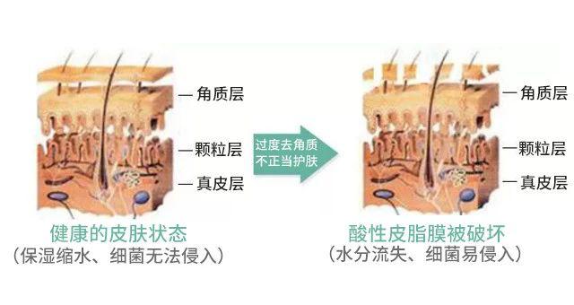 敏感肌肤角质层薄发红修复专用霜,角质层薄敏感肌肤适合哪些护肤品