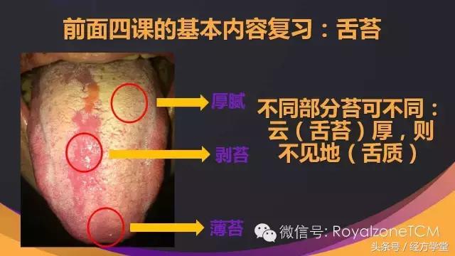 经方派舌诊,经典名方舌诊课